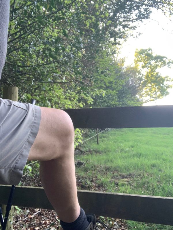 Bobby's leg as he climbs over a stile.